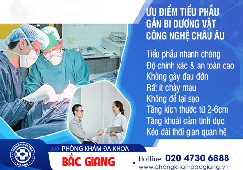 Chi phí gắn bi dương vật hiện nay