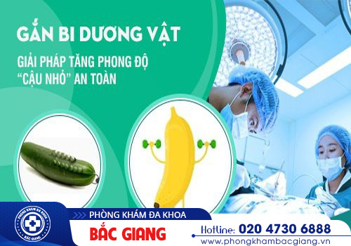 Chi phí gắn bi dương vật hiện nay