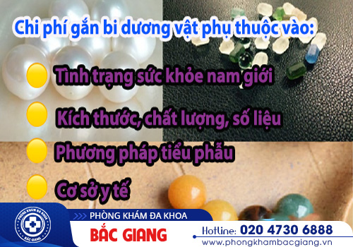 Chi phí gắn bi dương vật hiện nay