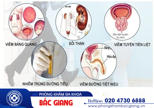Đi tiểu lắt nhắt có phải là bệnh nguy hiểm không