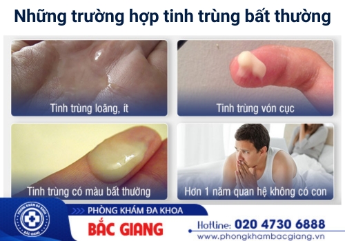 tinh trùng bất thường