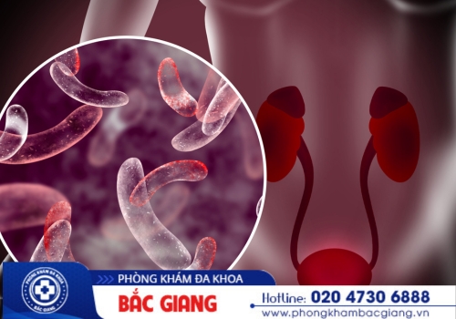 Biến chứng viêm đường tiết niệu 